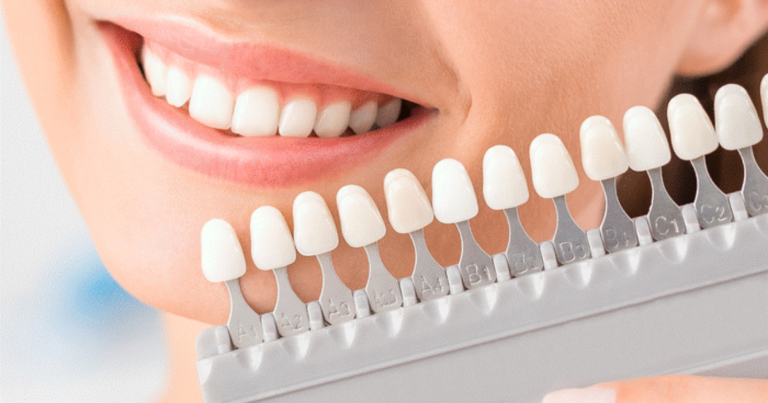 How Cosmetic Dentistry Boosts Self-Esteem and Well-Being