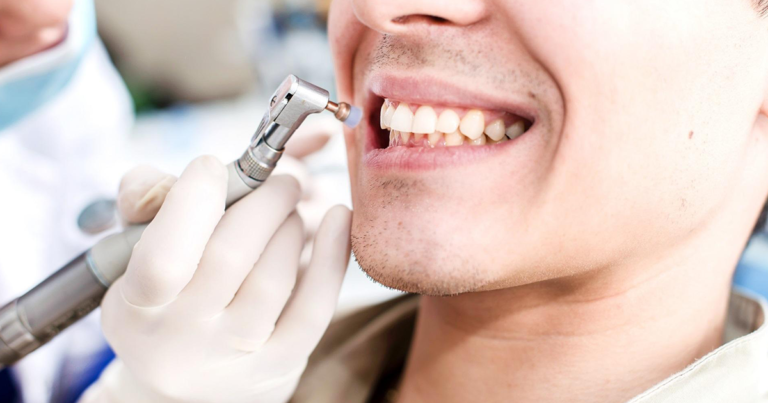 Dental Cleaning in Everett